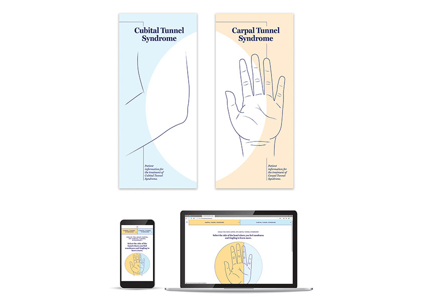 Carpal/Cubital Tunnel Patient Information Online by MicroAire Surgical Instuments
